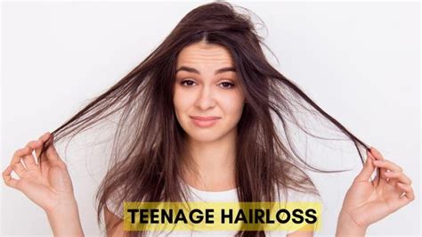 bold 16 years old|Teenage Hair Loss and Thinning: Symptoms, Causes, Treatment.